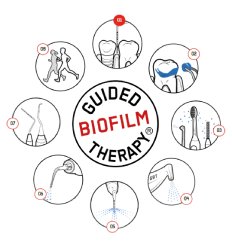 Guided Biofilm Therapy
